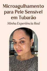 microagulhamento para pele sensível - resultados